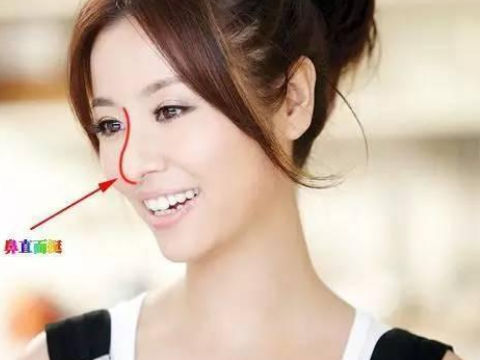 女生鼻孔大面相图解好不好