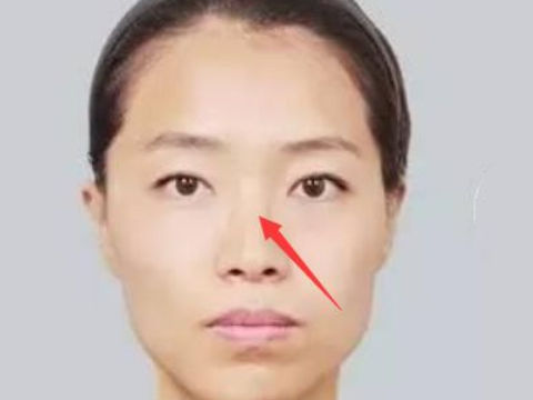 鼻梁塌陷的面相好不好