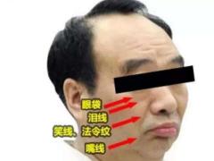 易离婚的男人面相有哪些