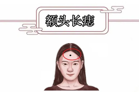 额头有痣的女人有什么寓意 额头有痣的女人图解