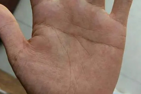 男人左手断掌是什么命 左手断掌纹的男人有什么说法