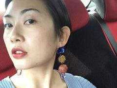 手指上有个肉包鼓起来,手指头有鼓起的小肉手相