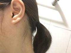 耳垂长痣有什么说法，耳垂有痣运势如何